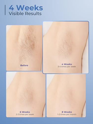 IPL Laser Hair Removal Device, 2026 Home Cooling IPL, Gift for Women