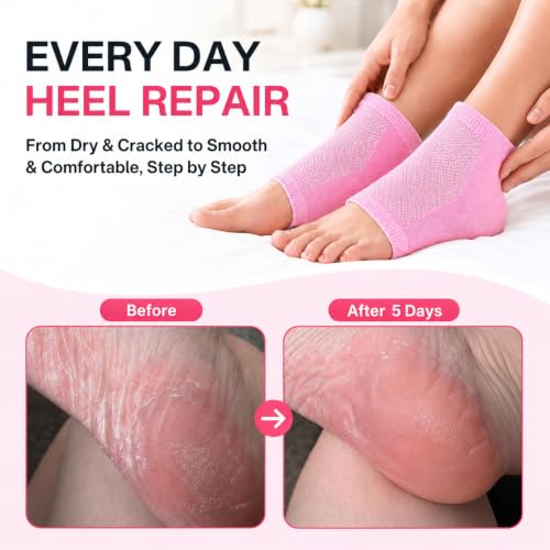 Moisturizing Socks Women, Heel Socks for Dry Cracked Feet, 100% Cotton Gel Socks for Overnight Hydration – Deep Moisturizing Foot Socks with Rose, Jojoba & Olive Oils, Pink, 2 Pairs