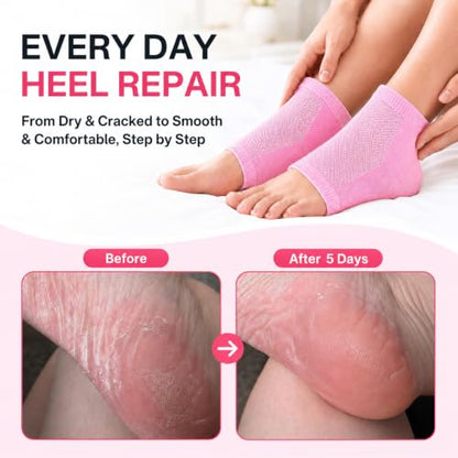 Moisturizing Socks Women, Heel Socks for Dry Cracked Feet, 100% Cotton Gel Socks for Overnight Hydration – Deep Moisturizing Foot Socks with Rose, Jojoba & Olive Oils, Pink, 2 Pairs
