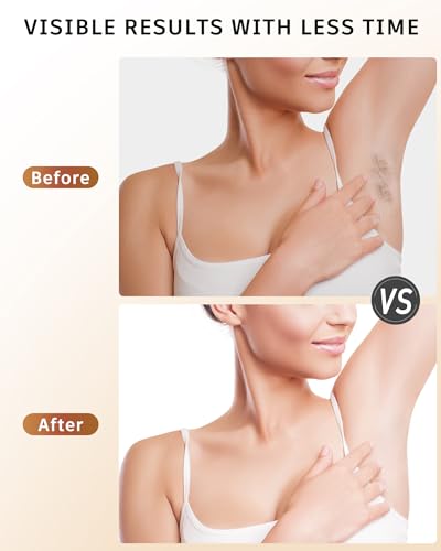 IPL Laser Hair Removal for Women & Men, Hair Removal Device