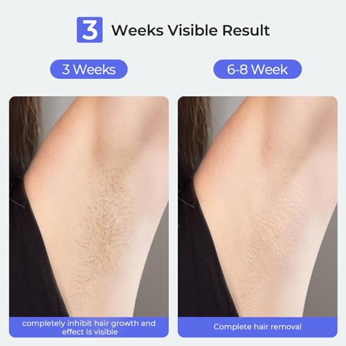 IPL Hair Removal Device for Women, Sapphire Ice Cooling 3.0, 21J Energy | Painless and Effective, 3 Modes, Alternative to Salon Laser Hair Removal at Home for Face Bikini Armpits Legs (White)