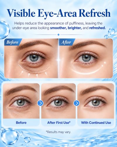 LAMVETHNY Caffeine Collagen Eye Masks - Korean Skincare Brightening Hydrating Anti Cooling Firming Non-Irritating for Appearance of Dark Circles&Wrinkles&Puffiness - Gift for Mom Traveler Night Worker (blue)