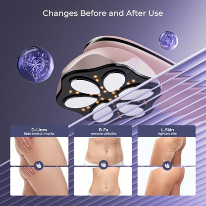 Cellulite Massage Tool - 4 in 1 Professional Body Sculpting Machine with 3 Modes, Heating Function10 Intensity Levels, Suitable for Belly, Waist, Buttocks, Arms, Legs, Wireless & Lightweight