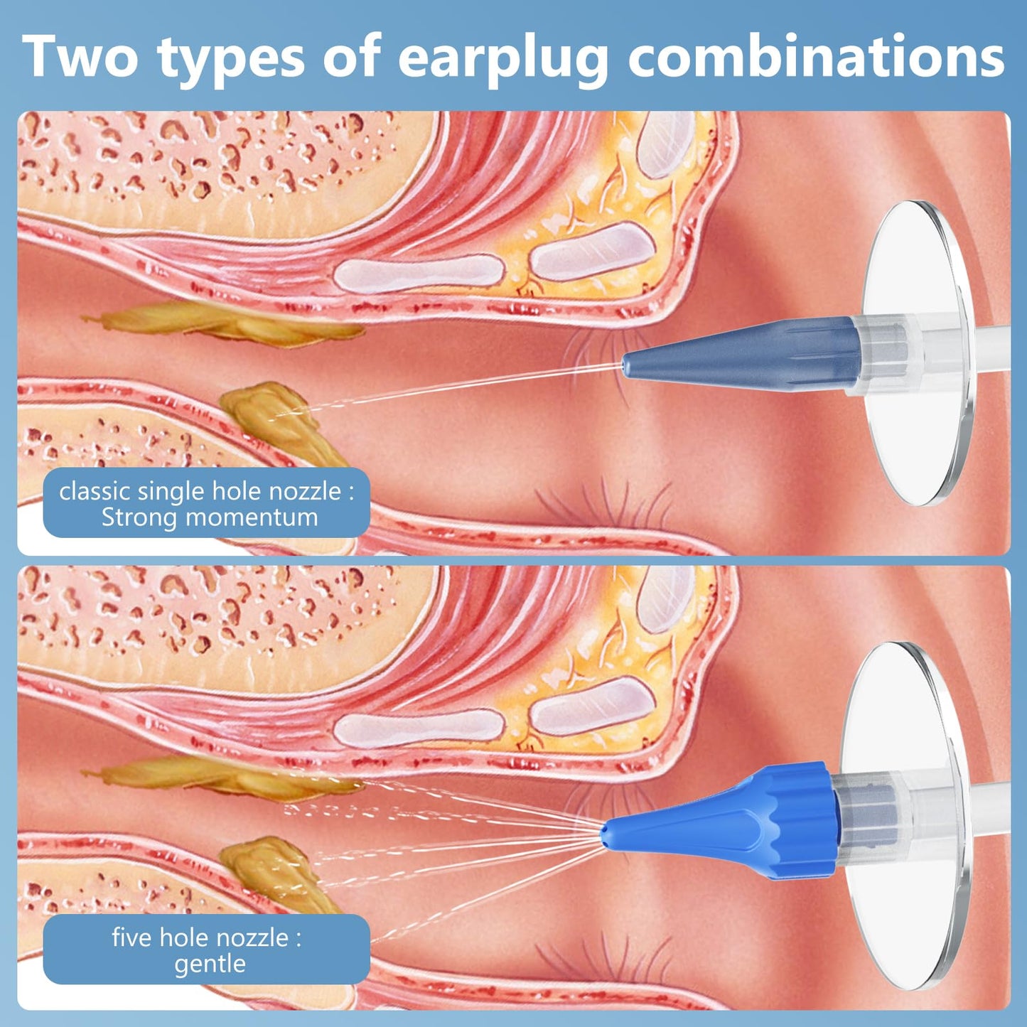 AZHE Ear Wax Romaval Kit, Ear Irrigation Flushing Cleanr with 10 Replaceable Tips, 1920P Ear cleaner with Camera with USB Charging, Manual Ear Cleaner for Home Use