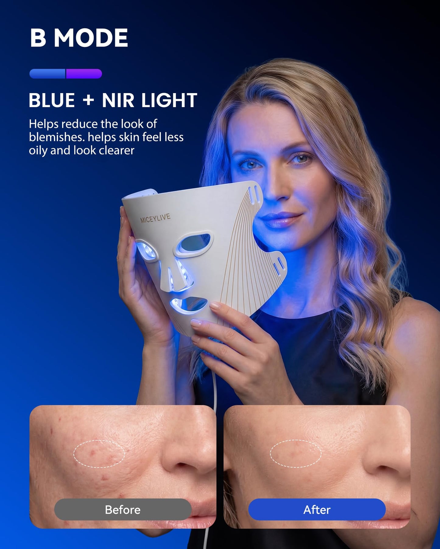 MICEYLIVE Red Light Mask for Face Near-Infrared LED Light Mask, White